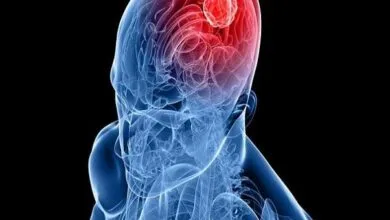 آلودگی هوا با تومورهای مغزی شایع مرتبط است