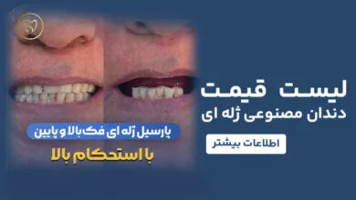 لیست قیمت دندان مصنوعی ژله ای 1404