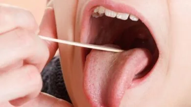 عمل لوزه در چه شرایطی ضروری است؟ بررسی دلایل و خطرات احتمالی جراحی لوزه عمل لوزه در چه شرایطی ضروری است؟ بررسی دلایل و خطرات احتمالی جراحی لوزه