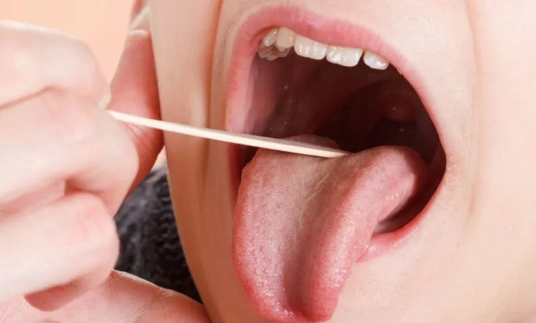 عمل لوزه در چه شرایطی ضروری است؟ بررسی دلایل و خطرات احتمالی جراحی لوزه