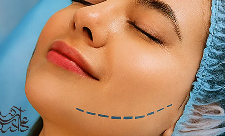 دکتر دادرس؛ شناخته‌شده‌ترین متخصص بوکال فت