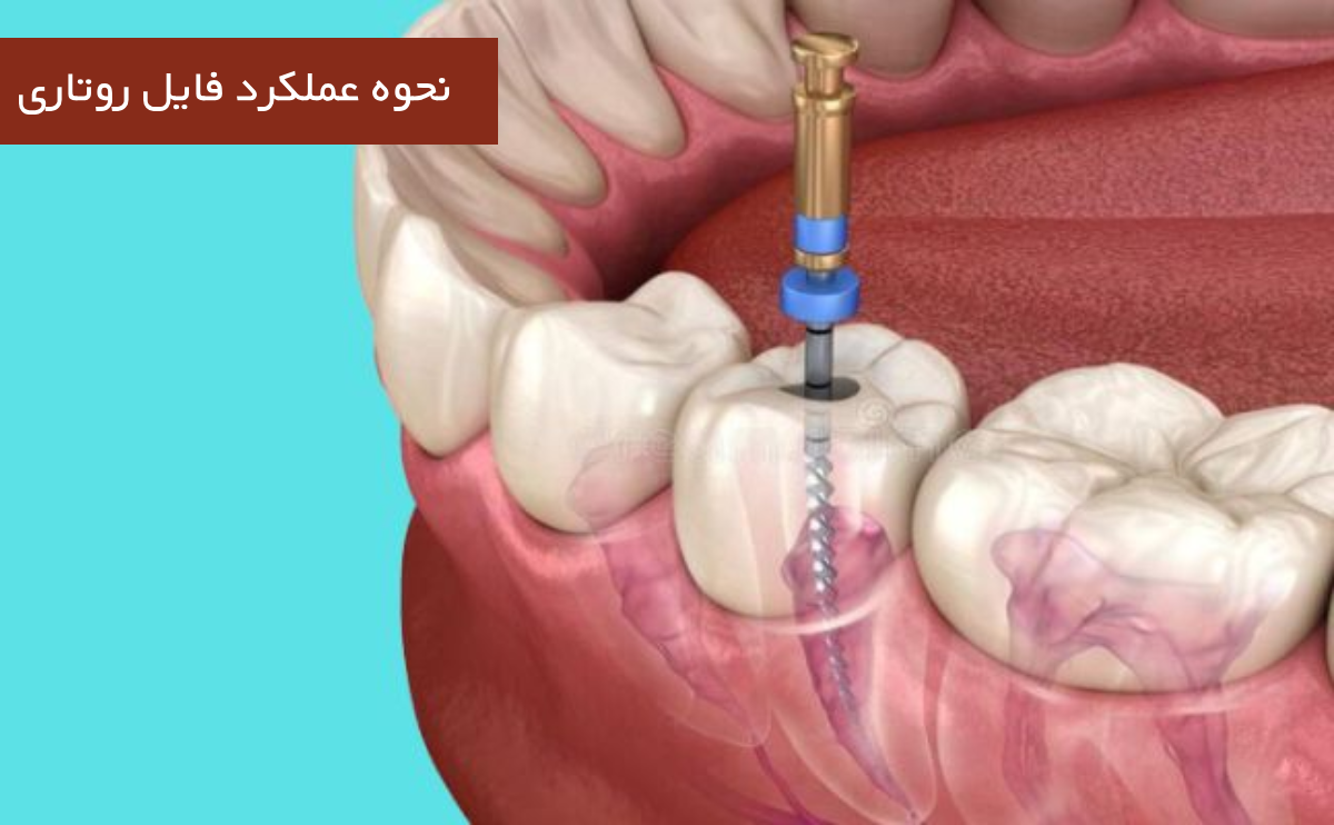 نحوه عملکرد فایل روتاری