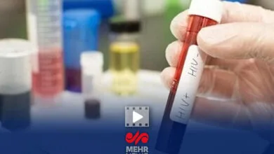 حدود ۴۱ هزار مبتلا به ویروس HIV در کشور